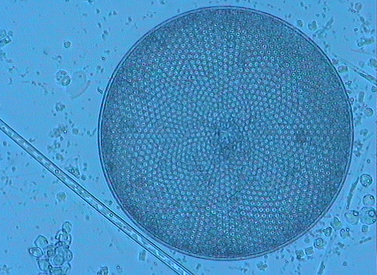 Dictyocha speculum